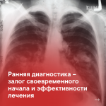 rak-lungs-1